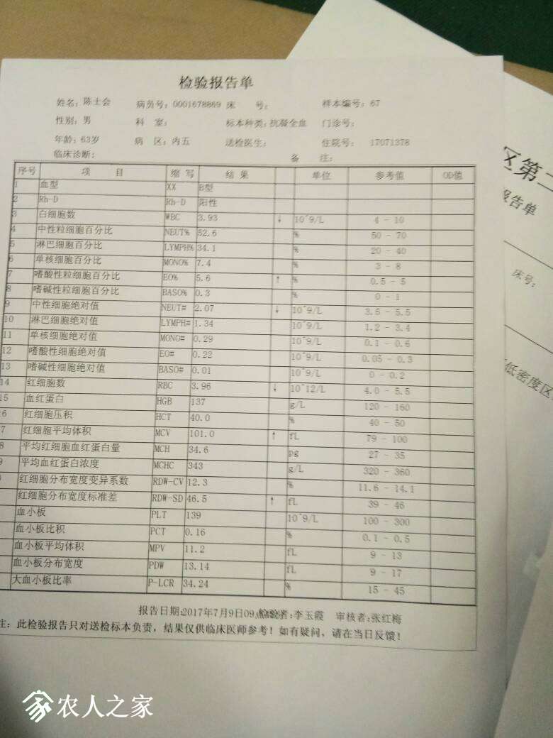 155353xeoxaxfdd4odwdpr.jpg